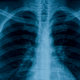 Image for article titled New Mucus Study Could Hold the Key to Clearing Your Phlegm